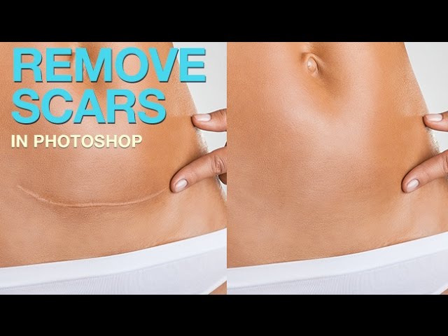 How to Remove a Scar in Photoshop