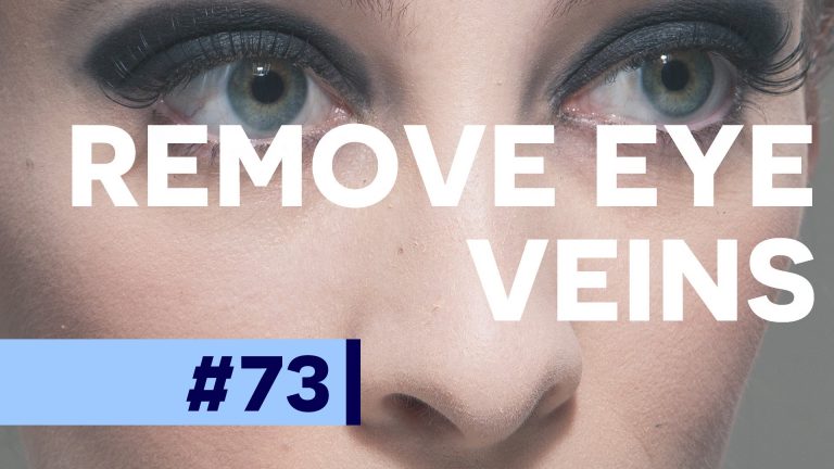 Remove Veins From Eyes – Photoshop CC Tutorial