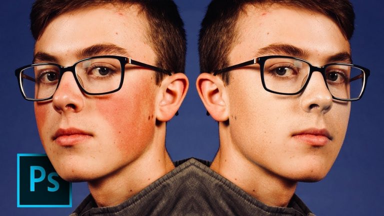 1-Minute Photoshop – Remove Red Patches from Skin
