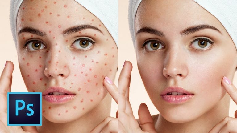 5 Best Ways to Clean Skin Blemishes and Heal Skin Photoshop Tutorial